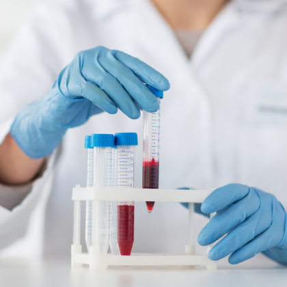 Lactose intolerance test: blood test